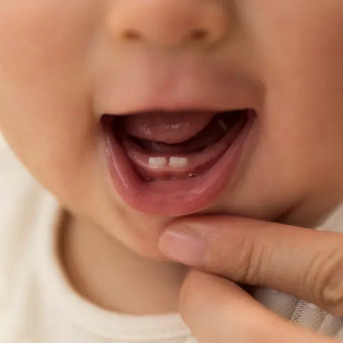 Baby Dental Care